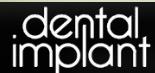 Clinica Dental Implant
