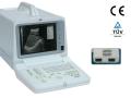 Ecograf portabil Chison 600M PRO cu sonda convexa C60 de 3,5 MHz multifrecventa (abdomen)