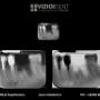 RADIOGRAFIE INTRAORALA