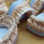 Ceramica pe suport de zirconiu
