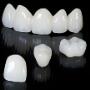Coroane si punti din Zirconium Cad Cam