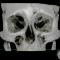 CBCT-SINUSURI-PARANAZALE